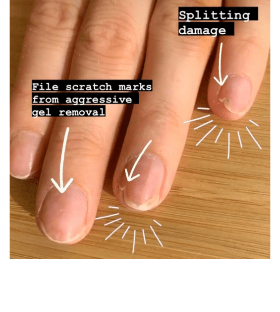 IBX might be the ultimate repairing treatment for damaged nails - here's  what you need to know - Treatwell